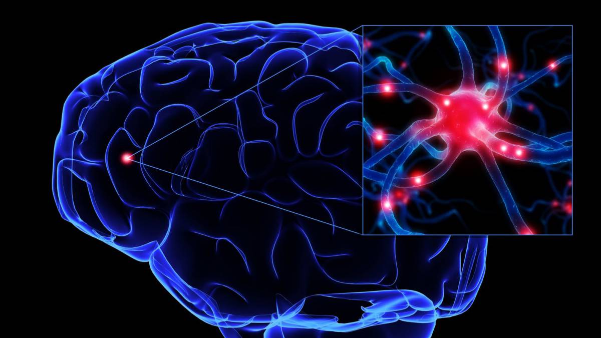 Cómo prevenir la afectación cerebral de las mucopolisacaridosis (MPS) - AS.com