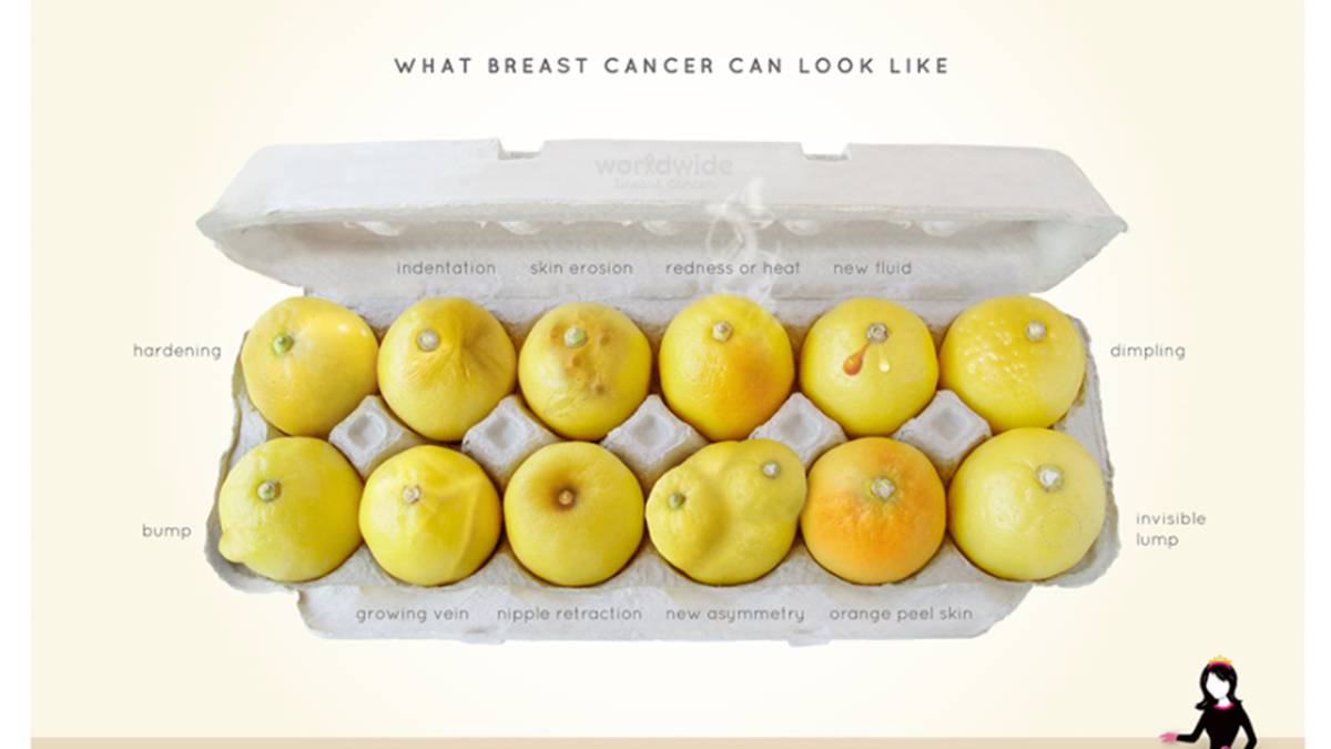 Conoce Tus Limones La Campana Viral Para Prevenir El Cancer De